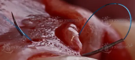 Aesthetics of surgery