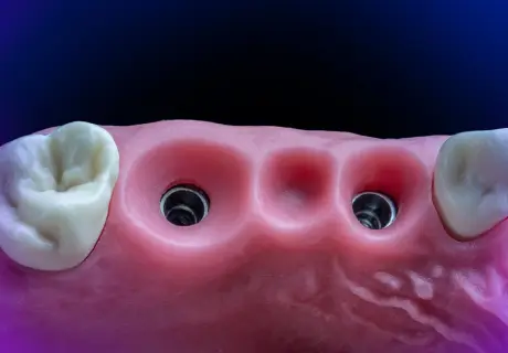 Dental phantom M1-Prosthetic