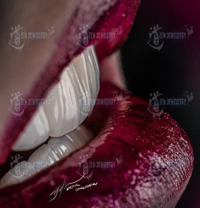 ArtPhoto 34