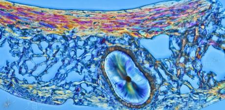 The alveolar bone