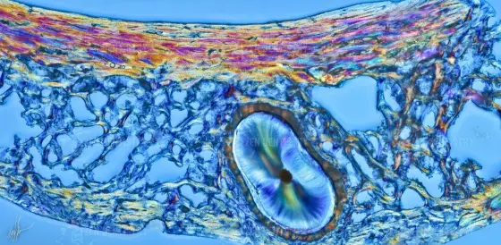 The alveolar bone