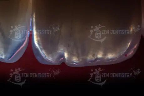 Cutting edge optics 1