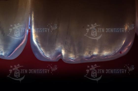 Cutting edge optics 1