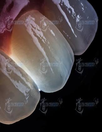 ArtPhoto 26