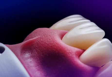 Dental phantom M2-PRO