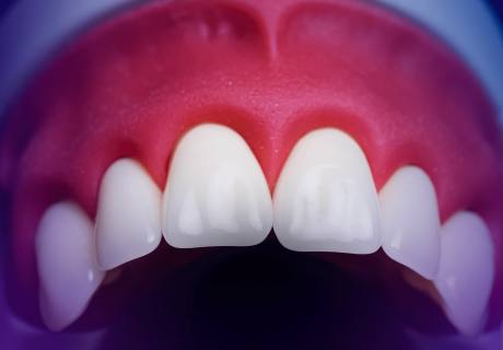 Dental phantom M2-PRO