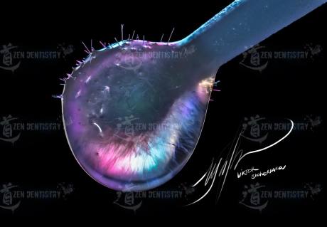 Drop of adhesive