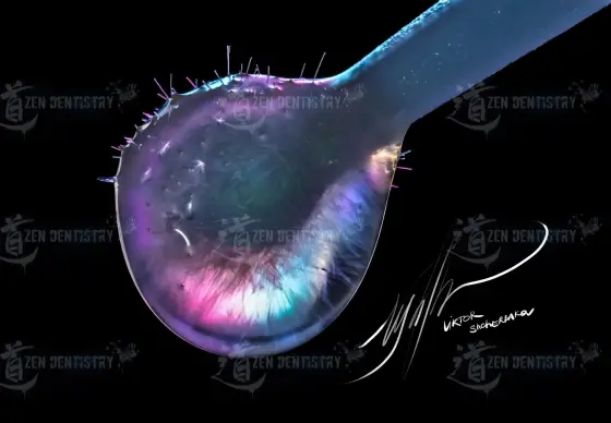 Drop of adhesive