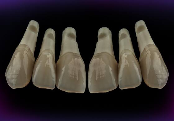 Set of the teeth for М2-LUX