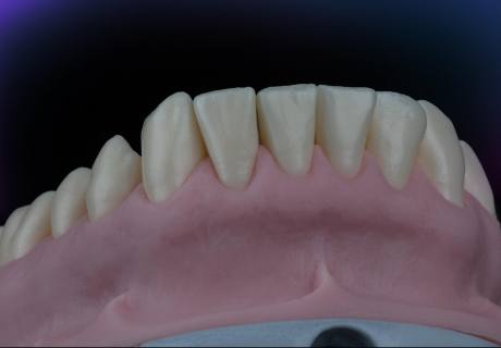 Dental phantom M1-Pro