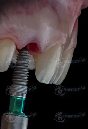Aesthetics of surgery