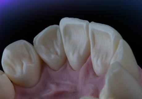Dental phantom M1-Pro