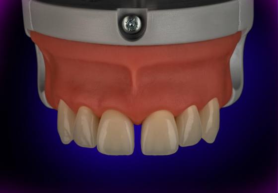 Dental phantom M2-PRO diastema