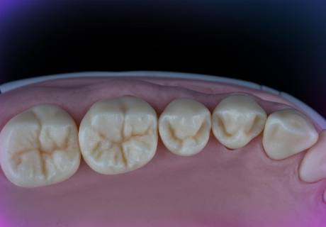 Dental phantom M1-Pro