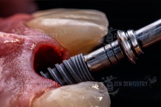 Aesthetics of surgery