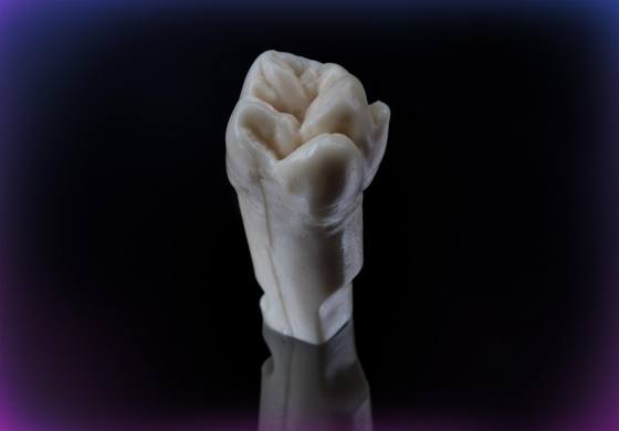 Single tooth M1-PRO
