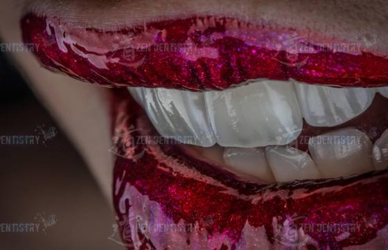 Photos of lips with different variations of decor