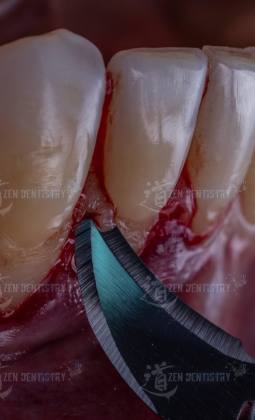 Aesthetics of surgery