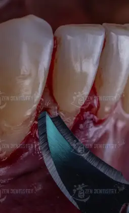Aesthetics of surgery