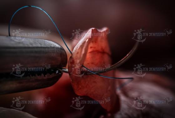 Aesthetics of surgery
