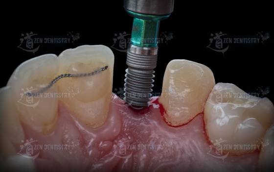 Aesthetics of surgery