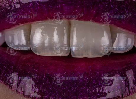 ArtPhoto 2