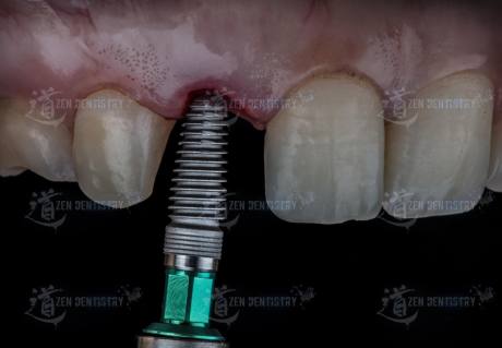 Aesthetics of surgery
