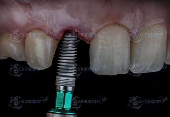 Aesthetics of surgery