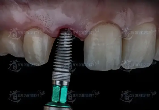 Aesthetics of surgery
