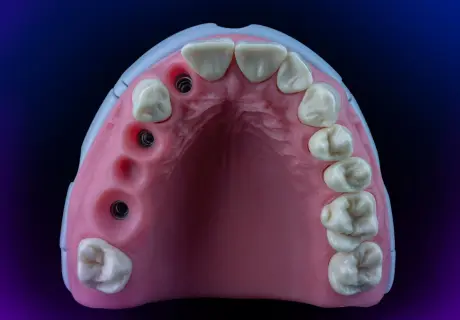 Dental phantom M1-Prosthetic