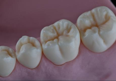 Dental phantom M1-Pro