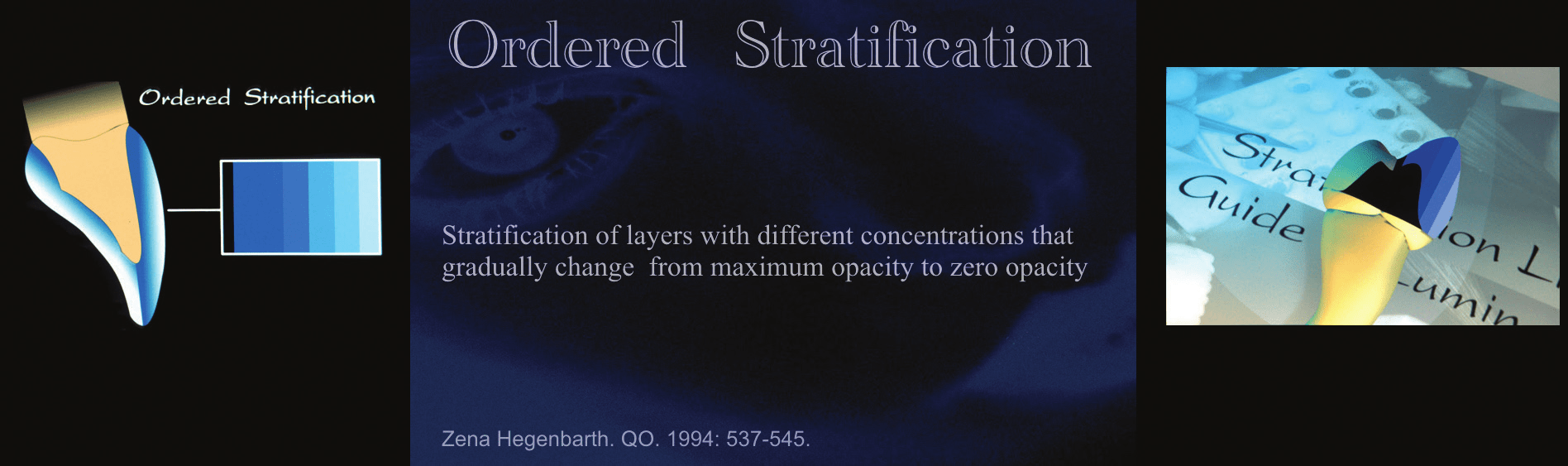 Multilayer Ceramic Layering