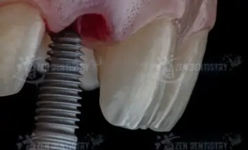 Aesthetics of surgery