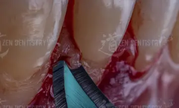 Aesthetics of surgery
