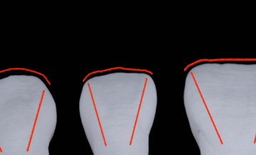 Dental Anatomical Combinations: A Guide to Ultimate Dental Esthetics